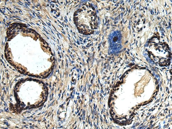 Polyclonal Rabbit anti-Human ERLIN1 / SPFH1 Antibody (IHC)