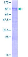 Human TOX2 Protein (Recombinant GST)