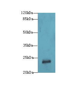 GAJ / MND1 Antibody