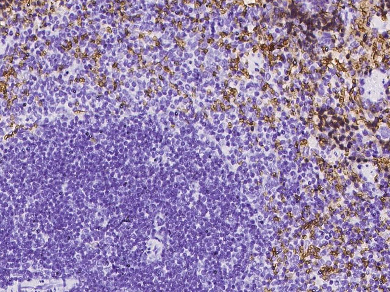 SLC4A1 / Band 3 / AE1 Antibody