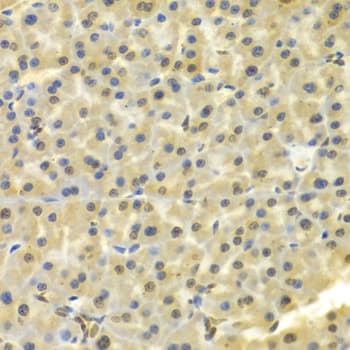 Polyclonal Rabbit anti-Human DKC1 / Dyskerin Antibody (IHC, IF, WB)