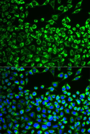 CYP51A1 / CYP51 Antibody