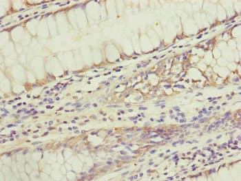 Polyclonal Rabbit anti-Human KIAA0391 Antibody (IHC, WB)