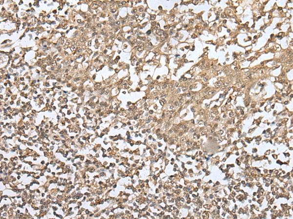 ZKSCAN1 / ZNF36 Antibody