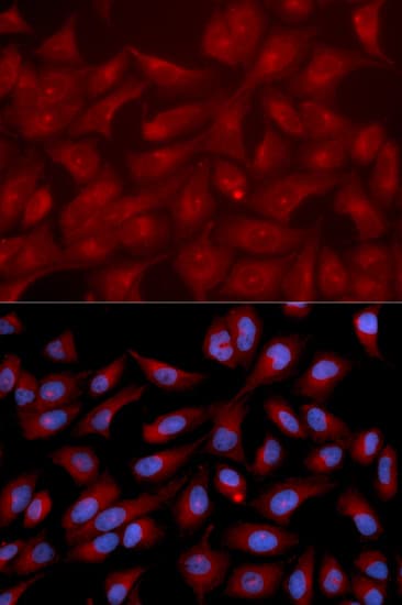 IHC-plus™ RAPGEF3 / EPAC Antibody