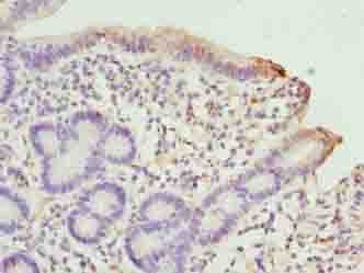 SCLT1 Antibody