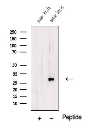 TMEM9 Antibody
