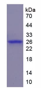 Human CCN5 Protein (Recombinant His)