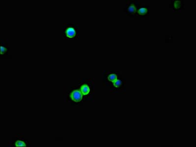 BRINP1 / DBC1 Antibody