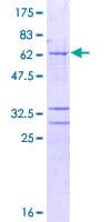 Human AMD / AMD1 Protein (Recombinant GST)