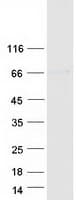 Human ACSM2B Protein (Recombinant Myc-DDK (Flag))