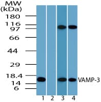 IHC-plus™ VAMP3 / VAMP-3 Antibody (aa1-50)