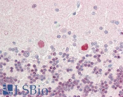 IHC-plus™ CUL5 / Cullin-5 Antibody (aa1-50)
