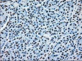 BRAF / B-Raf Antibody (clone OTI4C11)