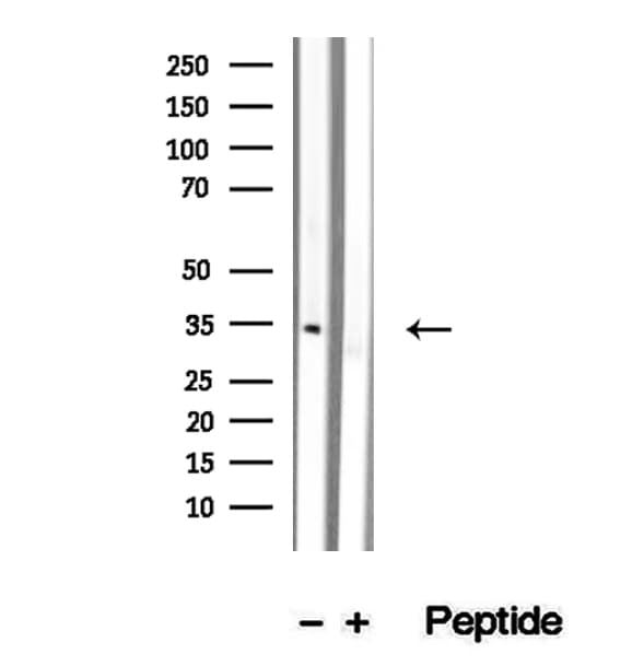 SULT1C2 / Sulfotransferase 1C2 Antibody
