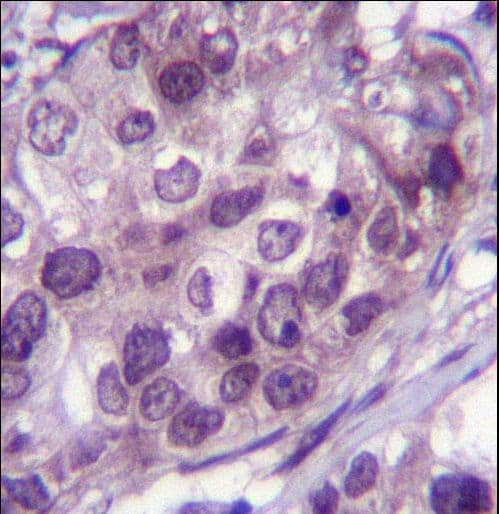 Polyclonal Rabbit anti-Human NR3C1/Glucocorticoid Receptor Antibody (aa236-262, IHC, IF, WB)