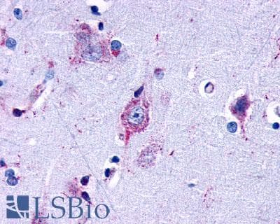 PathPlus™ Polyclonal Rabbit anti-Human LPAR3 / LPA3 / EDG7 Antibody (Cytoplasmic Domain, IHC)
