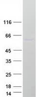 Human PELI1 / Pellino 1 Protein (Recombinant Myc-DDK (Flag))