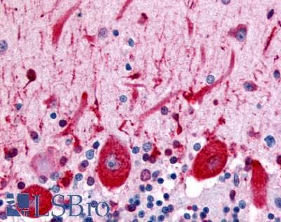 IHC-plus™ CELSR3 Antibody (N-Terminus)