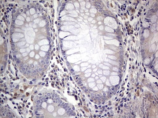 Monoclonal Mouse anti-Human PKM2 Antibody (clone 11B11, IHC, WB)