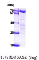 Human NELFA / WHSC2 Protein (Recombinant His)