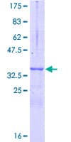 Human NGFRAP1 / NADE / Bex Protein (Recombinant GST)
