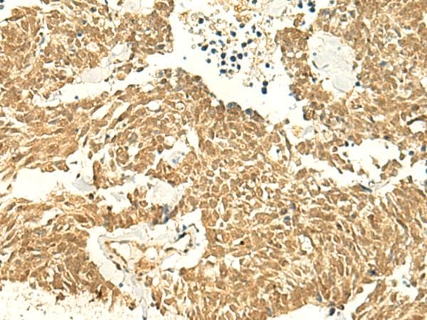 POLR3F Antibody