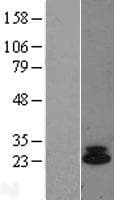 IL6 / Interleukin 6 Protein (Over-Expression Lysate Myc-DDK (Flag))