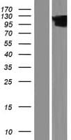 HCCS1 / VPS53 Protein (Over-Expression Lysate Myc-DDK (Flag))