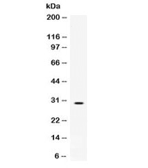 Polyclonal Rabbit anti-Human TPSAB1 / Mast Cell Tryptase Antibody (IHC, WB)