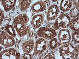 MAP2K1 / MKK1 / MEK1 Antibody (clone OTI2D2)