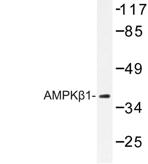 PRKAB1 / AMPK Beta 1 Antibody (Val175)