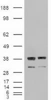 Monoclonal Mouse anti-Human NTF3 / Neurotrophin 3 Antibody (clone OTI5A2, IHC, IF, WB)