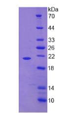 Human TNF Alpha Protein (Recombinant His)