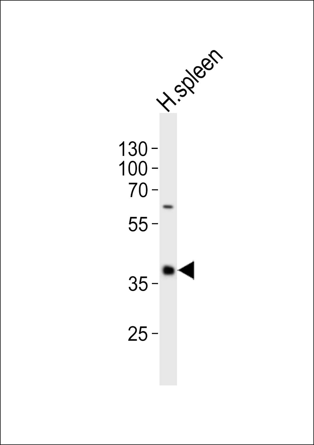 CD40 Antibody (aa247-276)