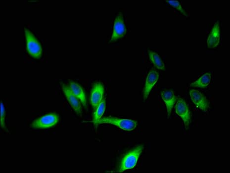 STMN1 / Stathmin / LAG Antibody