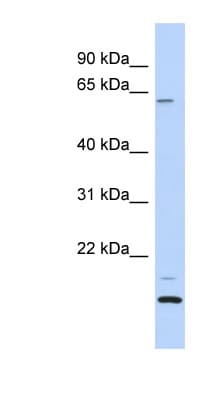 TCP11L2 Antibody (aa107-156)