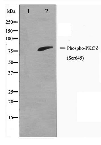 PRKCD / PKC-Delta Antibody (phospho-Ser645)