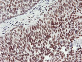 RNF113B Antibody (clone OTI2H5)