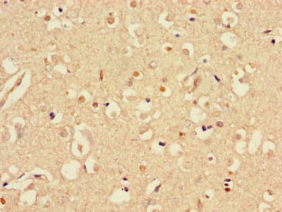 STMN1 / Stathmin / LAG Antibody
