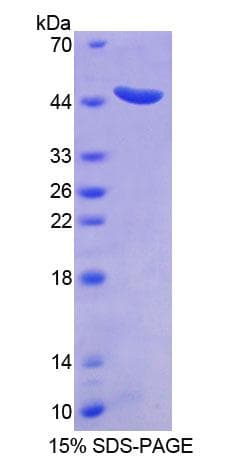 Human STAM2 Protein (Recombinant His-T7)
