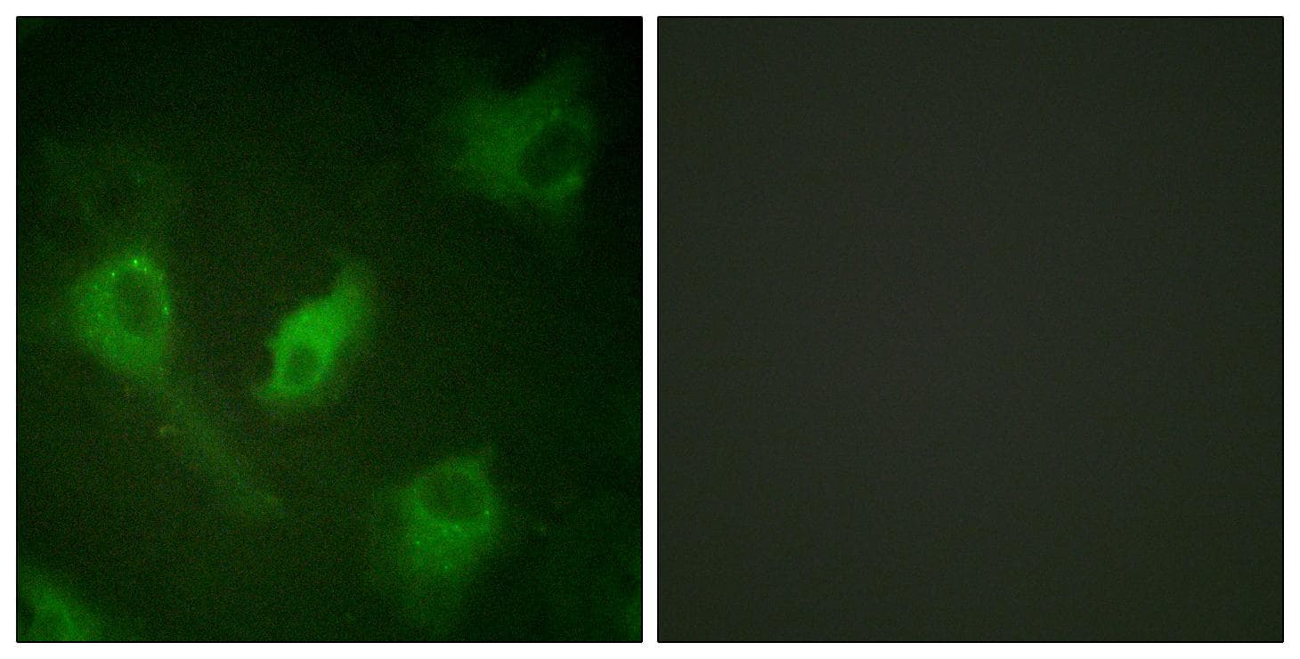 Polyclonal Rabbit anti-Human NFKBIE / IKB Epsilon Antibody (p22, IHC, IF, WB)