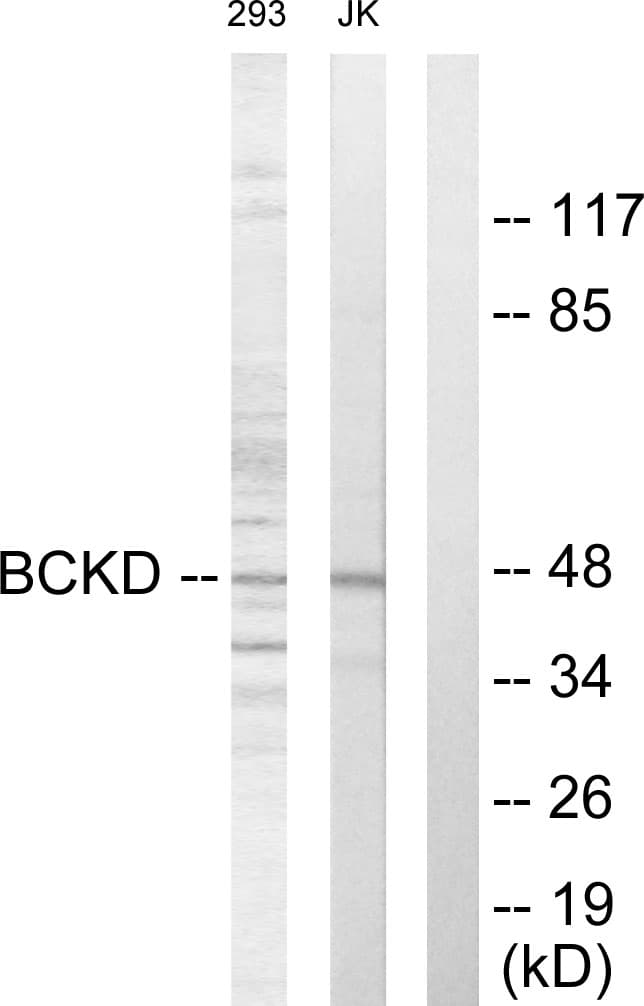 Polyclonal Rabbit anti-Human BCKDK Antibody (aa11-60, IF, WB)