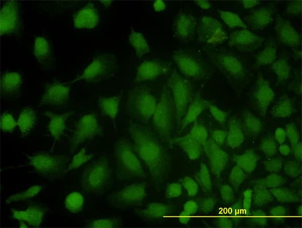 PathPlus™ MVP / VAULT1 Antibody (clone 2H3-1A6)