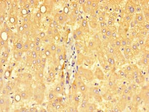 SART2 / DSE Antibody
