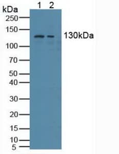 NCOA3 / SRC-3 / AIB1 Antibody (aa1023-1304, PE)