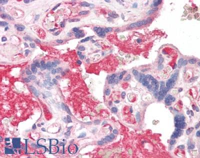 IHC-plus™ Sprouty 4 / SPRY4 Antibody