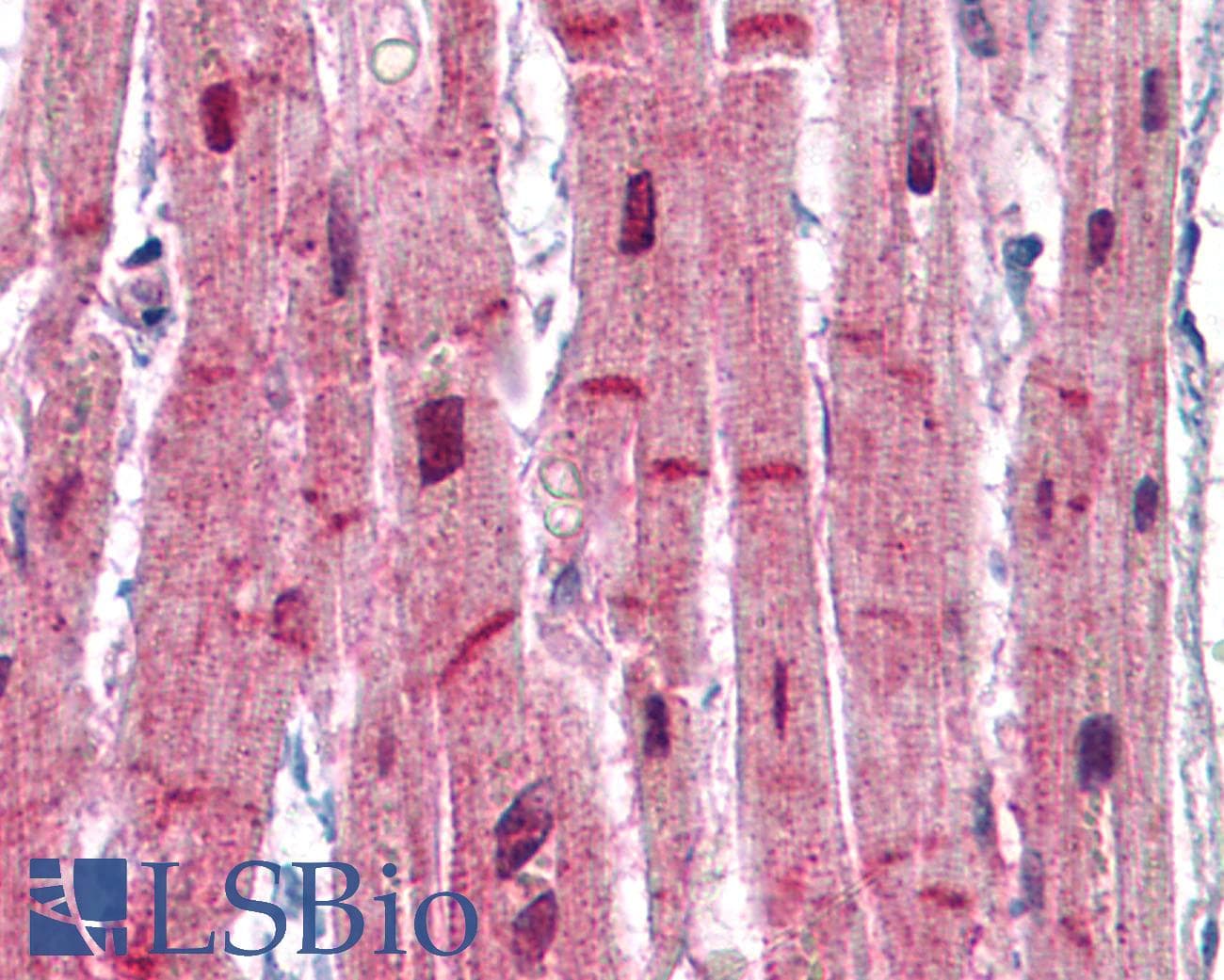 IHC-plus™ ACTN2 Antibody