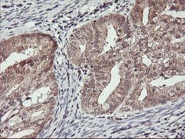 HLCS / HCS Antibody (clone OTI1E4)