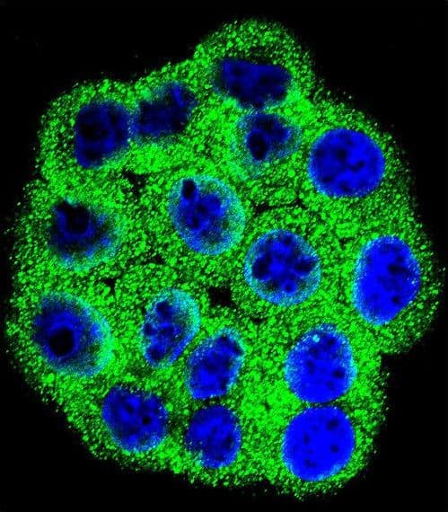Polyclonal Rabbit anti-Human CDKN2B / p15 INK4b Antibody (aa102-130, IHC, IF, WB)